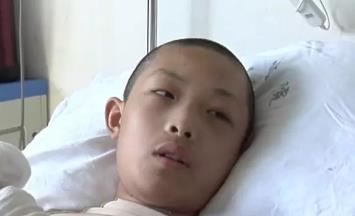 舍命救同伴！郑州13岁少年被烧成“黑炭” 右手不幸截肢